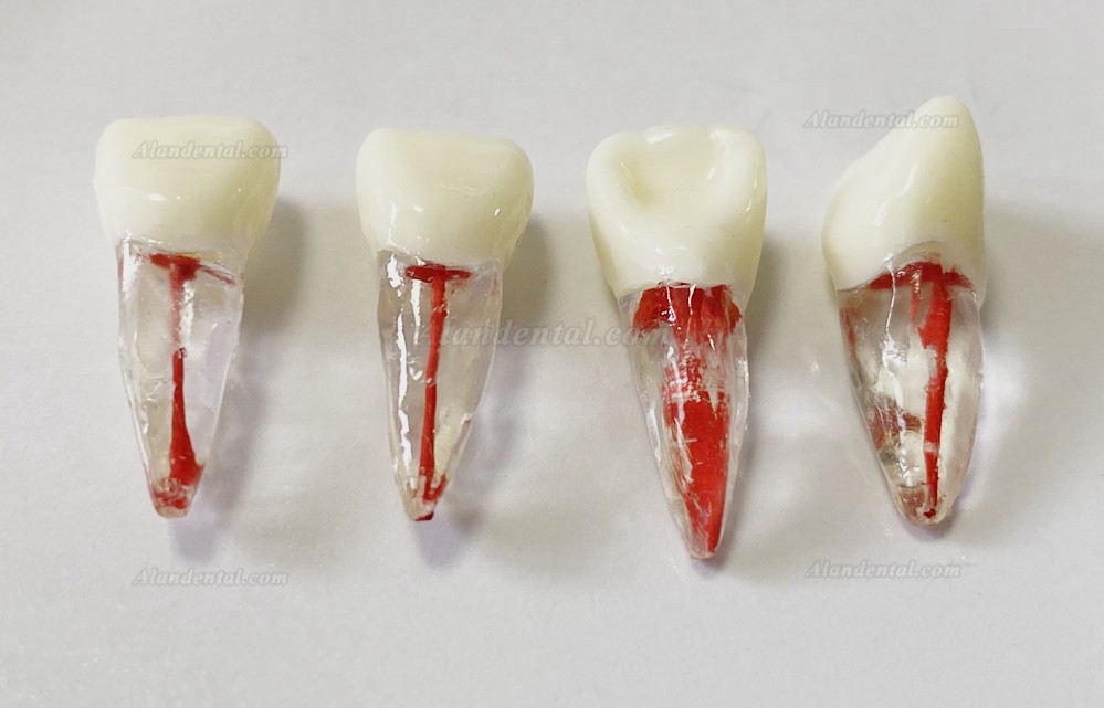 Dental Teeth Model Endo Files Practise Molar Upper Lower Tooth Premolar Root 2/3-Rooted Canal